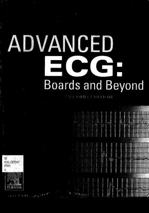 Advanced ECG: boards and beyond