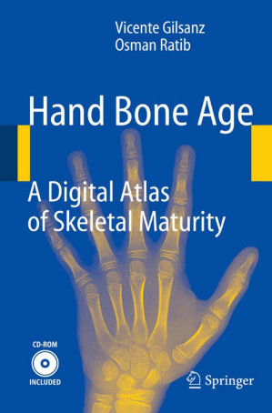 Hand Bone Age. A Digital Atlas of Skeletal Maturity