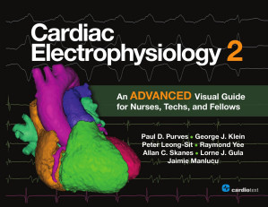 Cardiac Electrophysiology 2. An Advanced Visual Guide for Nurses, Techs, and Fellows
